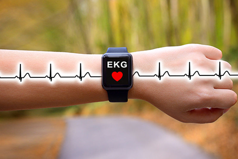 september Minearbejder husmor Weihnachten steht vor der Tür - Macht es Sinn, als Herzpatient eine  Smartwatch mit EKG-Funktion zu kaufen? | HAMBURG-SCHOCKT rettet Leben -  machen Sie mit!